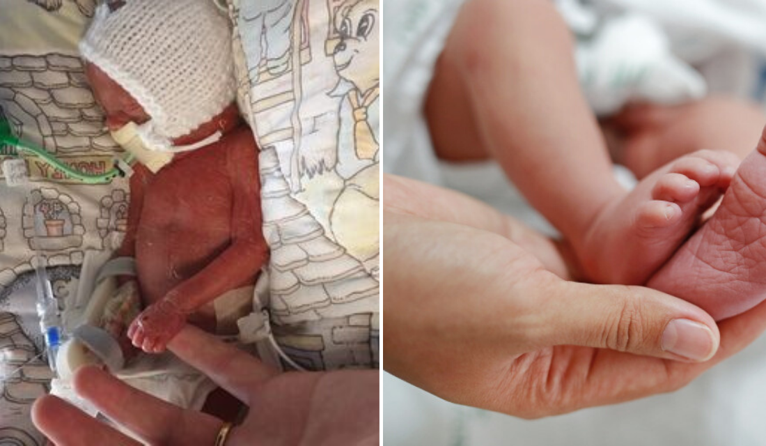 Bebê de apenas 7 polegadas que nasceu na quarentena continua bem