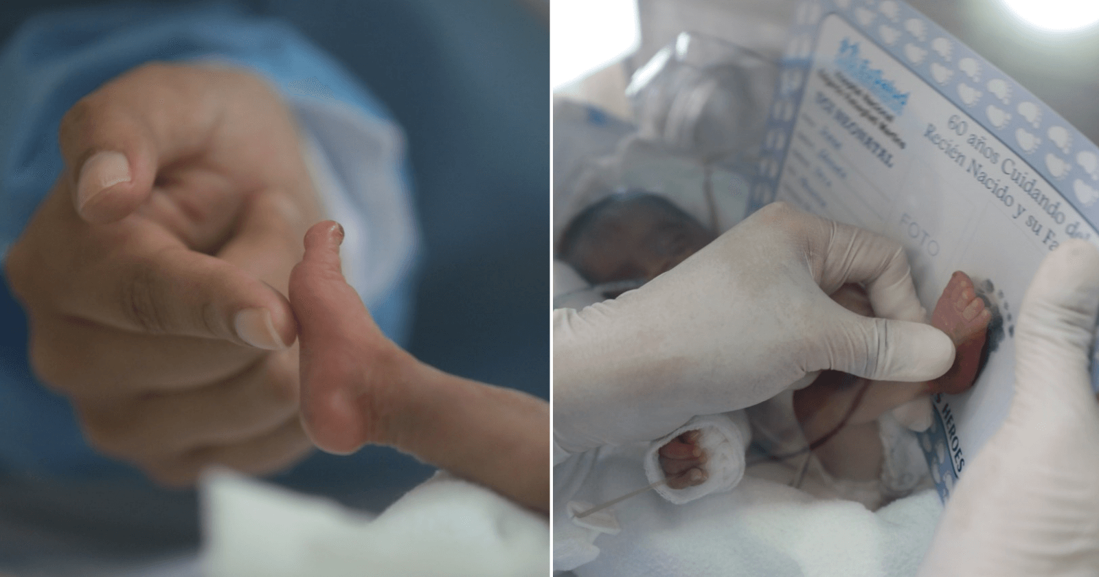 Bebê que nasceu prematuro e com apenas 930 gramas vence a Covid-19