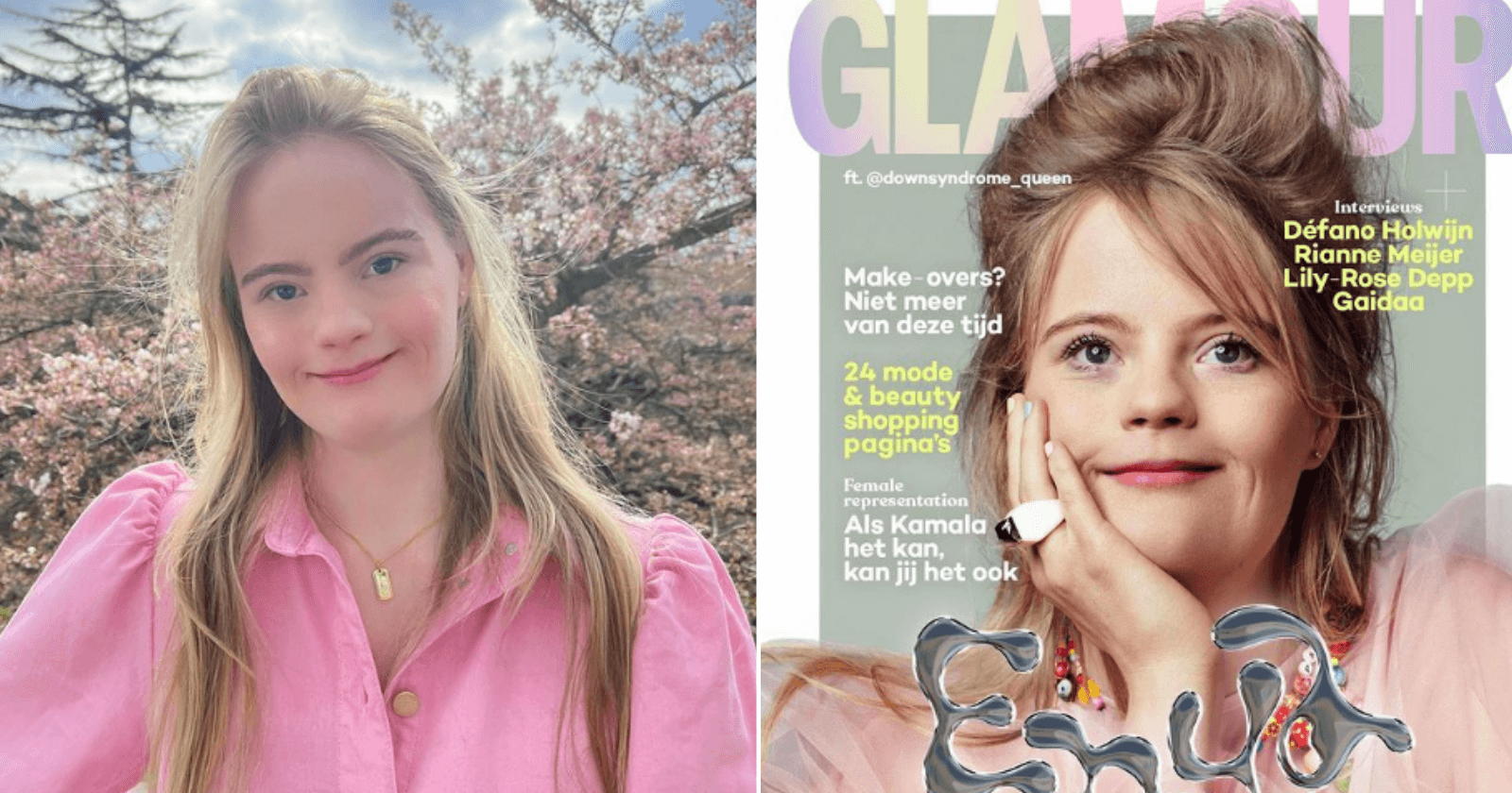 Garota com Down vira capa de revista holandesa e comemora inclusão