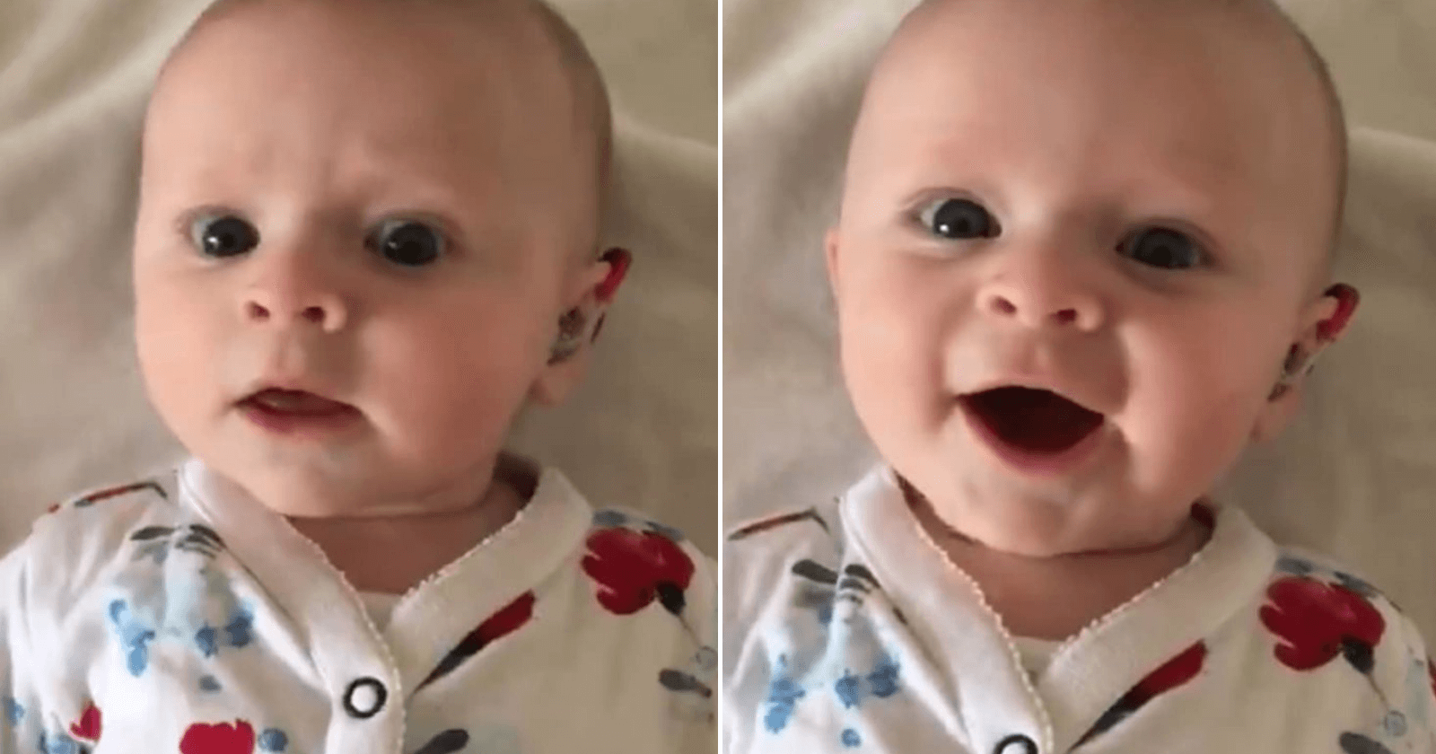 Bebê ganha aparelhos auditivos e ao ouvir voz da mãe tem linda reação