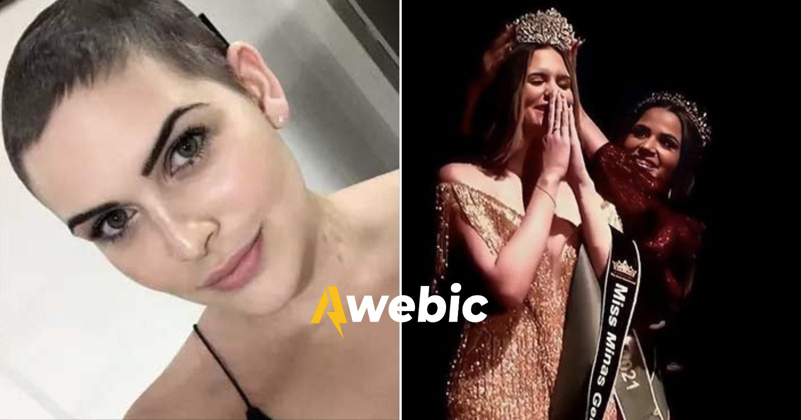 VITÓRIA! Modelo vence câncer e ganha o miss Brasil Internacional