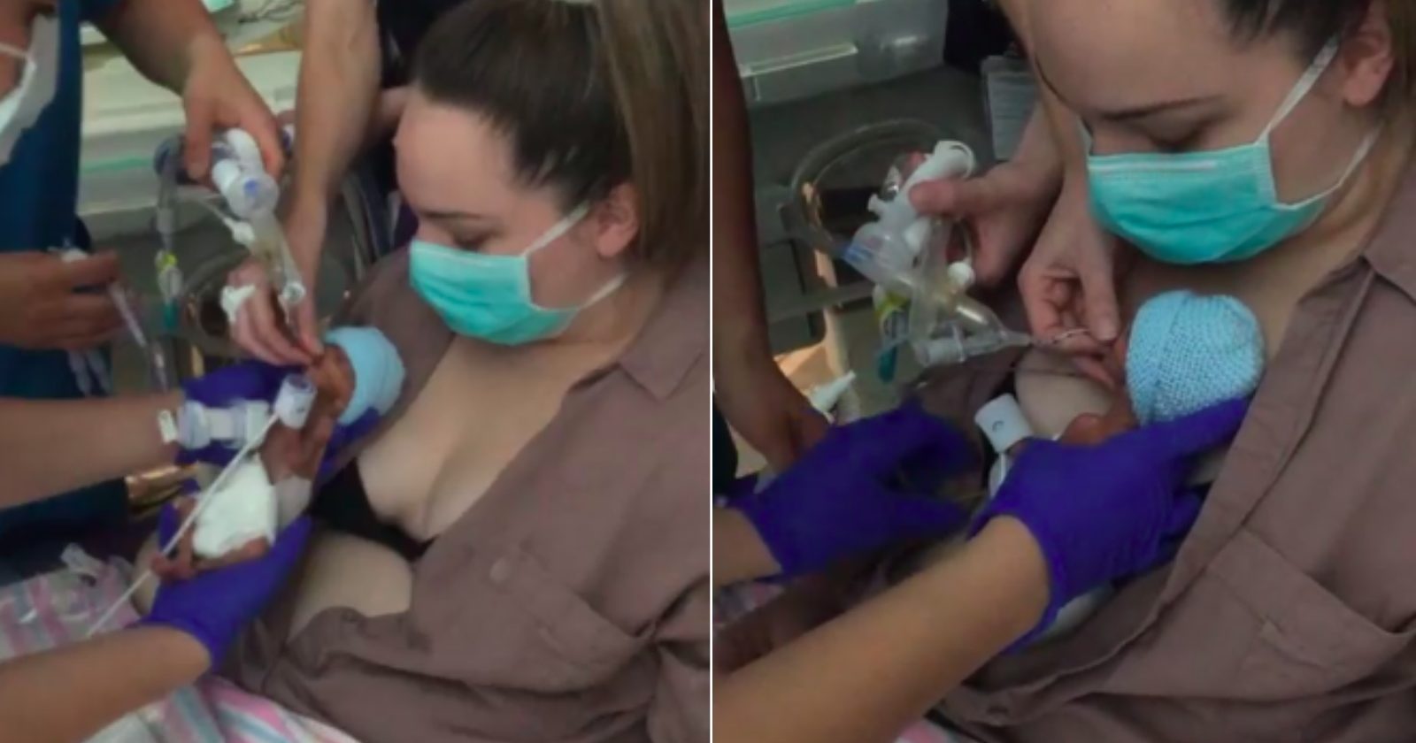 Vídeo de mãe abraçando bebê prematuro pela 1ª vez transmite a emoção do momento