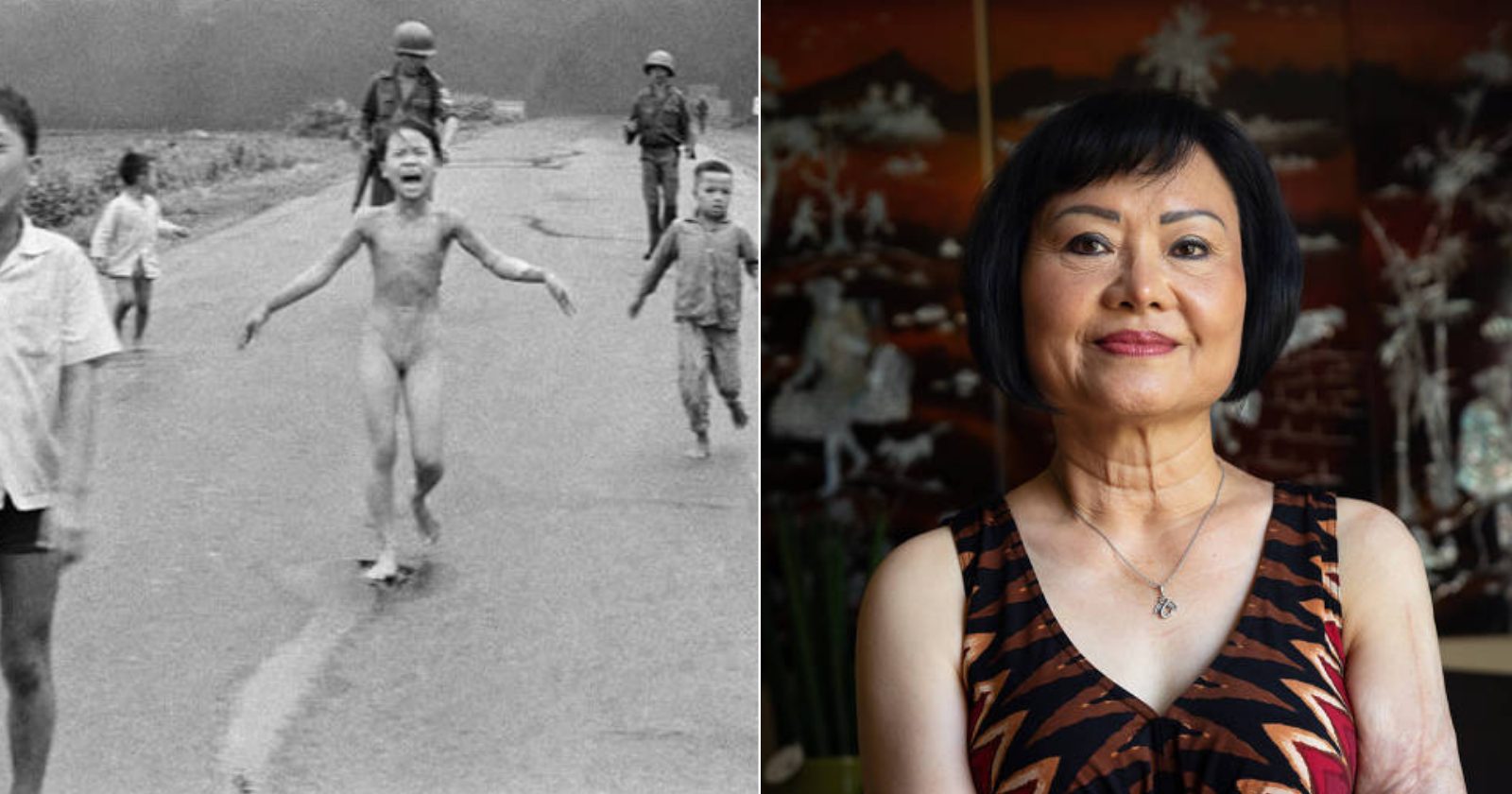 Após 50 anos, mulher da foto na Guerra do Vietnã, passa por último procedimento das cicatrizes