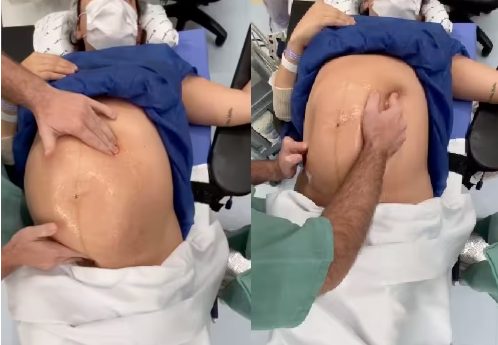 Vídeo impressionante mostra "manobra" feita por médico antes do parto (Imagens: Reprodução)